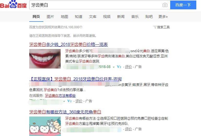 牙齒美白